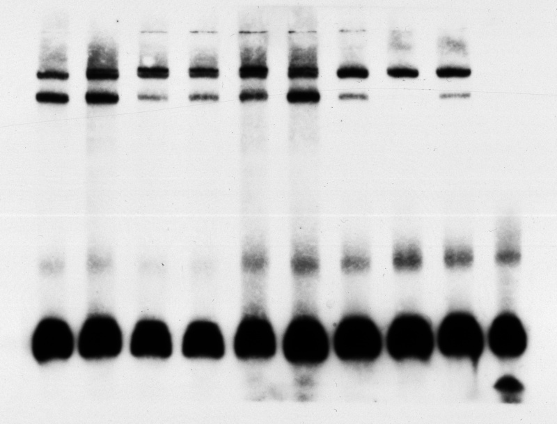 EMSA and supershift - Protein and Proteomics